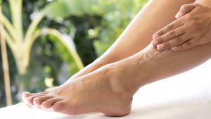 femme appliquant une crème sur ses jambes varices